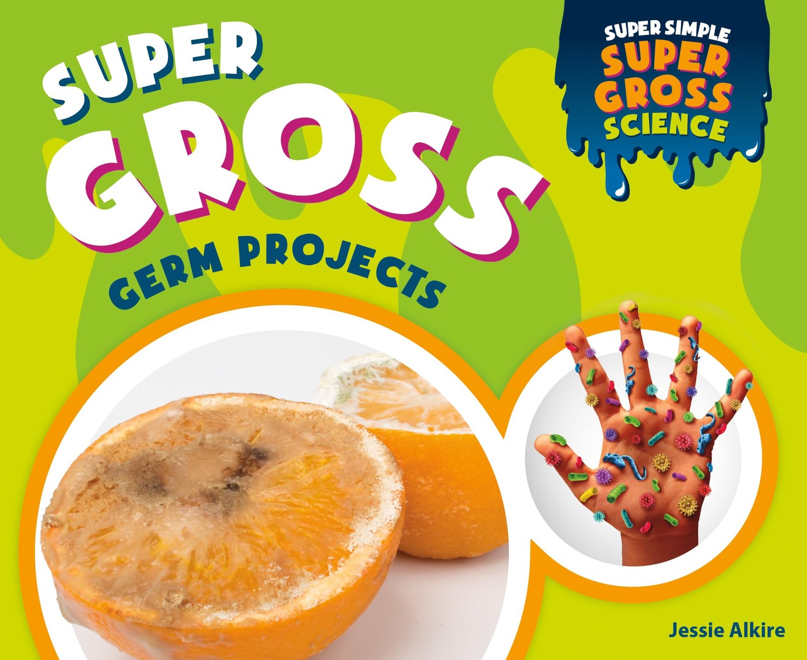Super Gross Germ Projects (Super Simple Super Gross Science) – Alkire, Jessi…