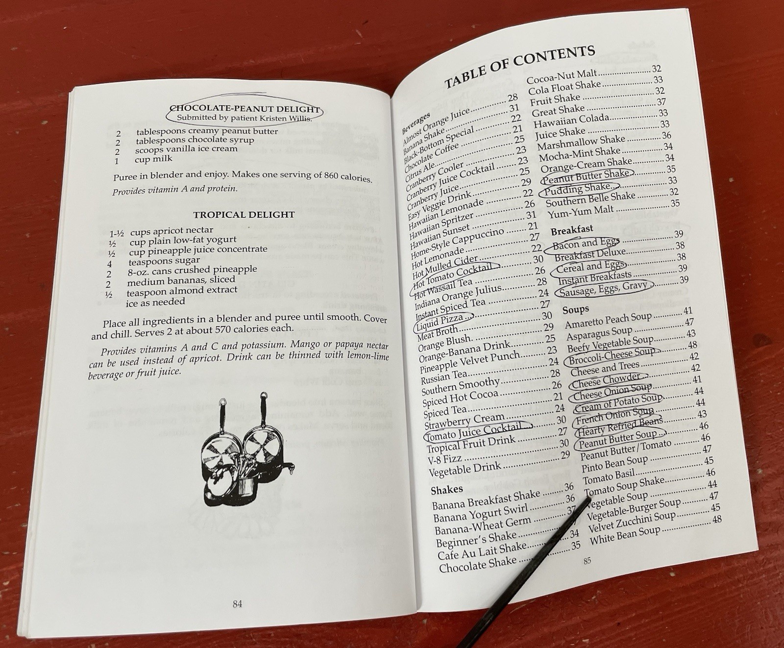 Dinner Through a Straw Without the Straw A Handbook for Maxillary Trauma PB 2006